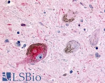 PathPlus™ Polyclonal Rabbit anti-Human CHRM2 / M2 Antibody (Cytoplasmic Domain, IHC)