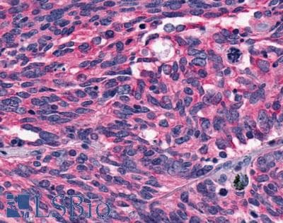 PathPlus™ Polyclonal Rabbit anti-Human MCHR1 Antibody (N-Terminus, IHC)
