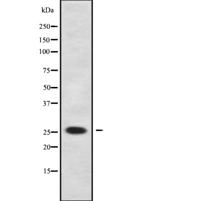 TCEAL2 Antibody