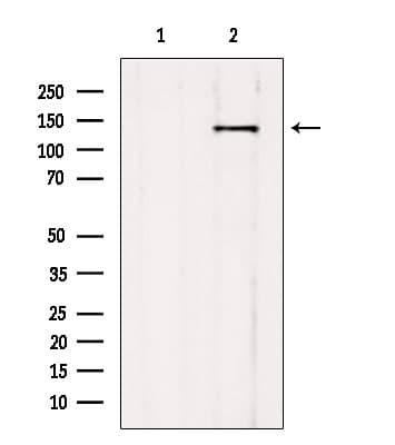 Polyclonal Rabbit anti-Human NNA1 / AGTPBP1 Antibody (IHC, WB)