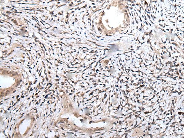 UBN1 / Ubinuclein 1 Antibody