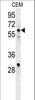 IKZF1 / IKAROS Antibody (aa415-444)
