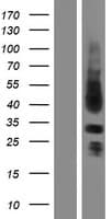 SPRY3 / Sprouty 3 Protein (Over-Expression Lysate Myc-DDK (Flag))
