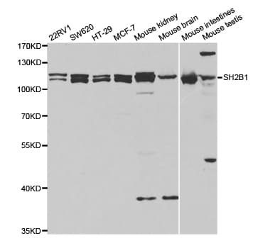 Polyclonal Rabbit anti-Human SH2B1 Antibody (IHC, IF, WB)
