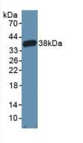 CARD9 Antibody (aa274-530, APC)