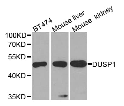 DUSP1 / MKP1 Antibody