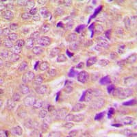 TBC1D4 / AS160 Antibody (Internal)