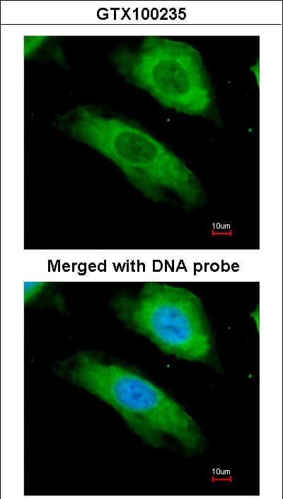 NQO1 Antibody (aa213-274)