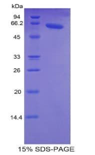 Human TNNC2 Protein (Recombinant His-MBP)