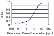 Monoclonal Mouse anti-Human FZD4 / Frizzled 4 Antibody (clone 3G7, WB)
