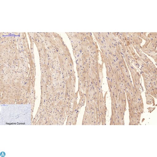 Monoclonal Mouse anti-Human NBR1 Antibody (WB)
