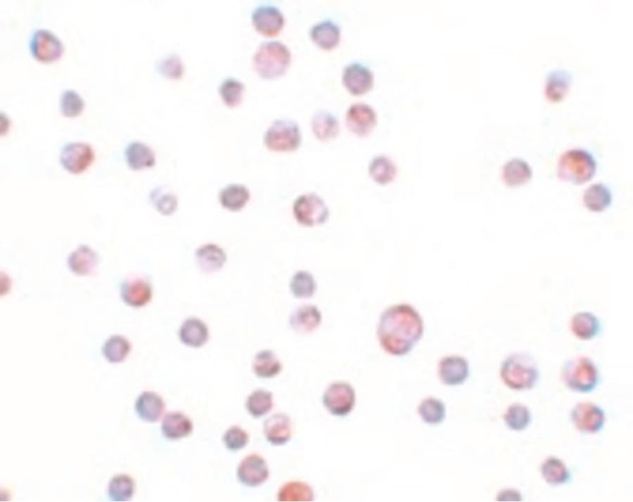 Polyclonal Rabbit anti-Human PARP13 / ZC3HAV1 Antibody (IF, WB)