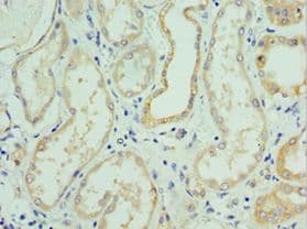 Polyclonal Rabbit anti-Human SLC39A6 / LIV-1 Antibody (aa170-320, IHC)