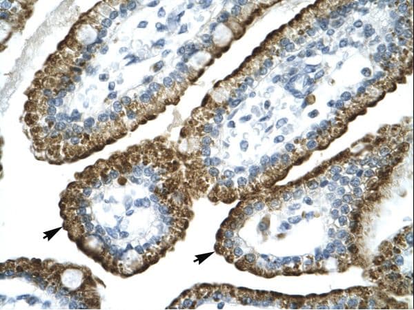 Polyclonal Rabbit anti-Human GABRP Antibody (FITC, aa28-77, IHC, WB)