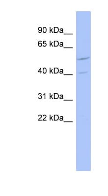 ZNF232 Antibody (N-Terminus)