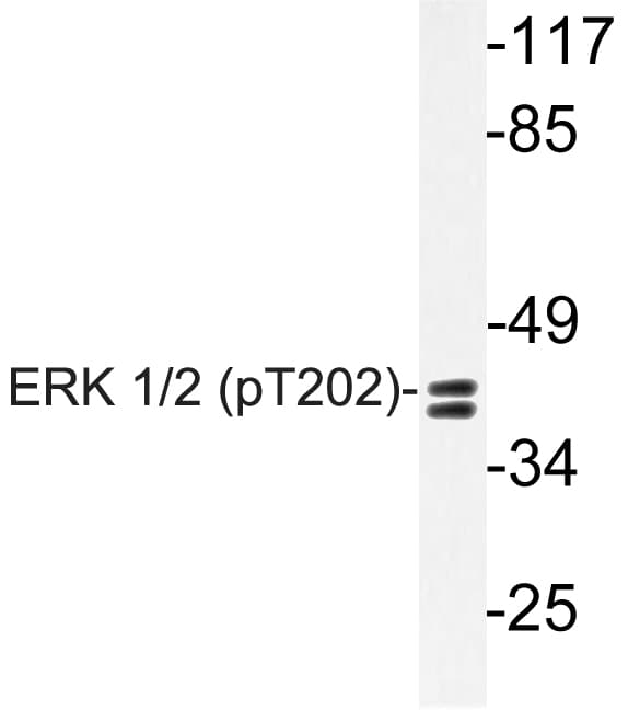 Polyclonal Rabbit anti-Human ERK1 + ERK2 Antibody (phospho-Thr202, WB)