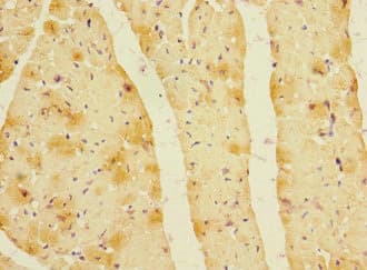 LDB3 / ZASP Antibody