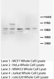 PTGS2 / COX2 / COX-2 Antibody (N-Terminus, Sepharose)