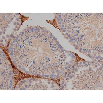 MAPT / Tau Antibody (phospho-Ser404)
