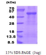 Human ENTPD3 Protein (Recombinant His)