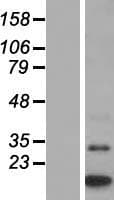 MTCP1 Protein (Over-Expression Lysate Myc-DDK (Flag))