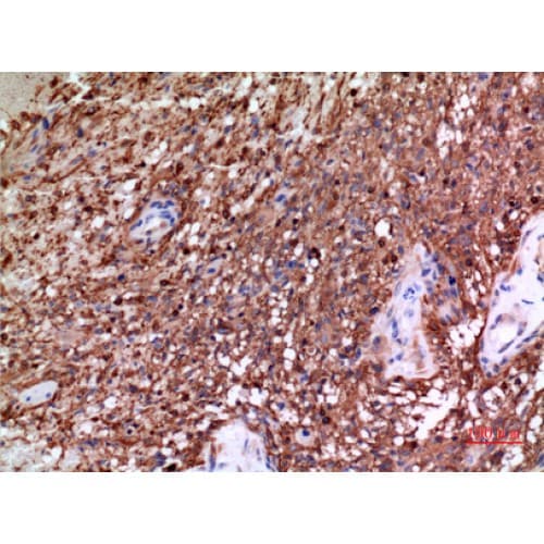Polyclonal Rabbit anti-Human Alpha Tubulin Antibody (IHC, WB)