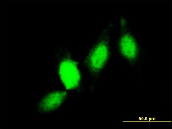 GSTP1 / GST Pi Antibody (clone 2G6-F6)