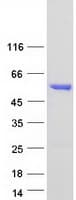 Human ALDH6A1 Protein (Recombinant Myc-DDK (Flag))