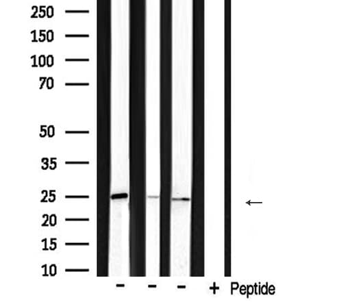 BAK1 / BAK Antibody