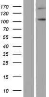 NLRP9 Protein (Over-Expression Lysate Myc-DDK (Flag))