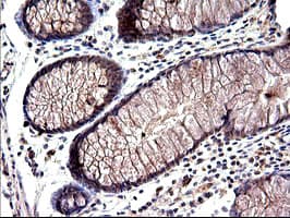 SHBG Antibody (clone OTI1D10)