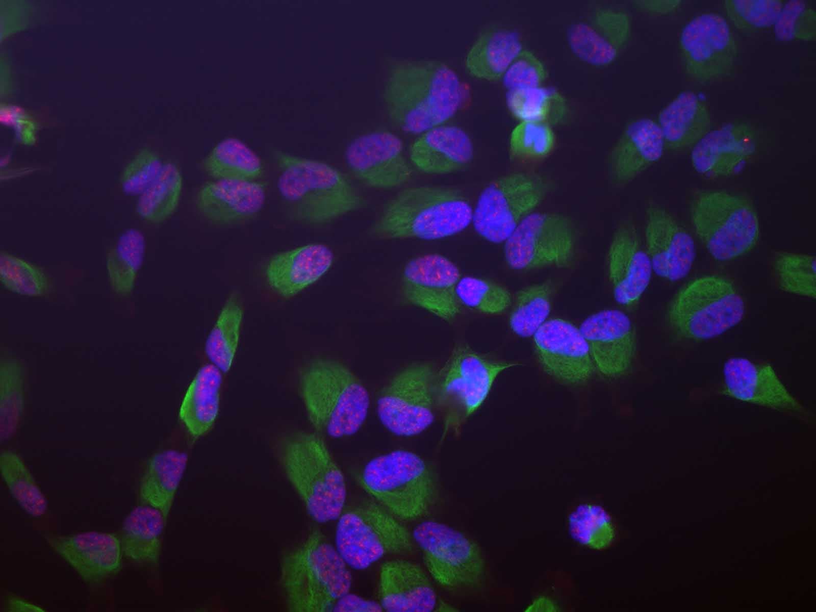 IHC-plus™ Monoclonal Mouse anti-Human SF3B4 Antibody (clone 3A1, IHC, IF, WB)