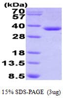 Human HADH Protein (Recombinant His)