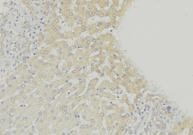 CLN6 Antibody