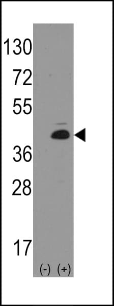 Polyclonal Rabbit anti-Human ATOH1 / MATH-1 Antibody (aa78-109, WB)