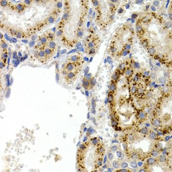 IHC-plus™ PPP1R1B / DARPP-32 Antibody