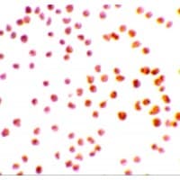 Polyclonal Rabbit anti-Human DRAK1 / STK17A Antibody (IF, WB)