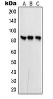 PFKP Antibody (Internal)