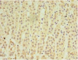 MATN3 / Matrilin 3 Antibody (aa277-486)