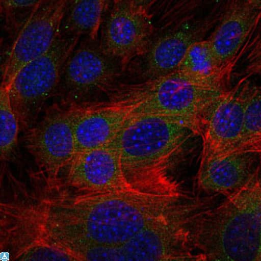 FGG / Fibrinogen Gamma Antibody