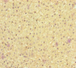 Polyclonal Rabbit anti-Human MOCS2 Antibody (IHC, IF, WB)