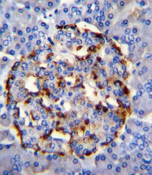 Polyclonal Rabbit anti-Human PLA2G2D Antibody (aa105-131, IHC, WB)