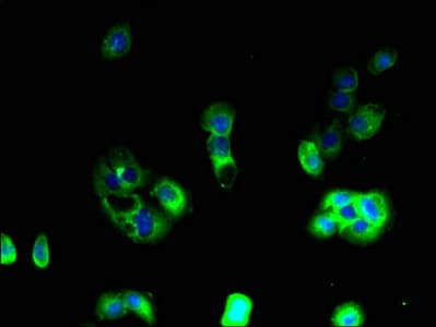 Polyclonal Rabbit anti-Human APLNR/ Apelin Receptor / APJ Antibody (IHC)