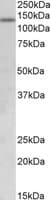 IHC-plus™ Polyclonal Goat anti-Human JHDM1A / KDM2A Antibody (aa139-153, IHC, WB)