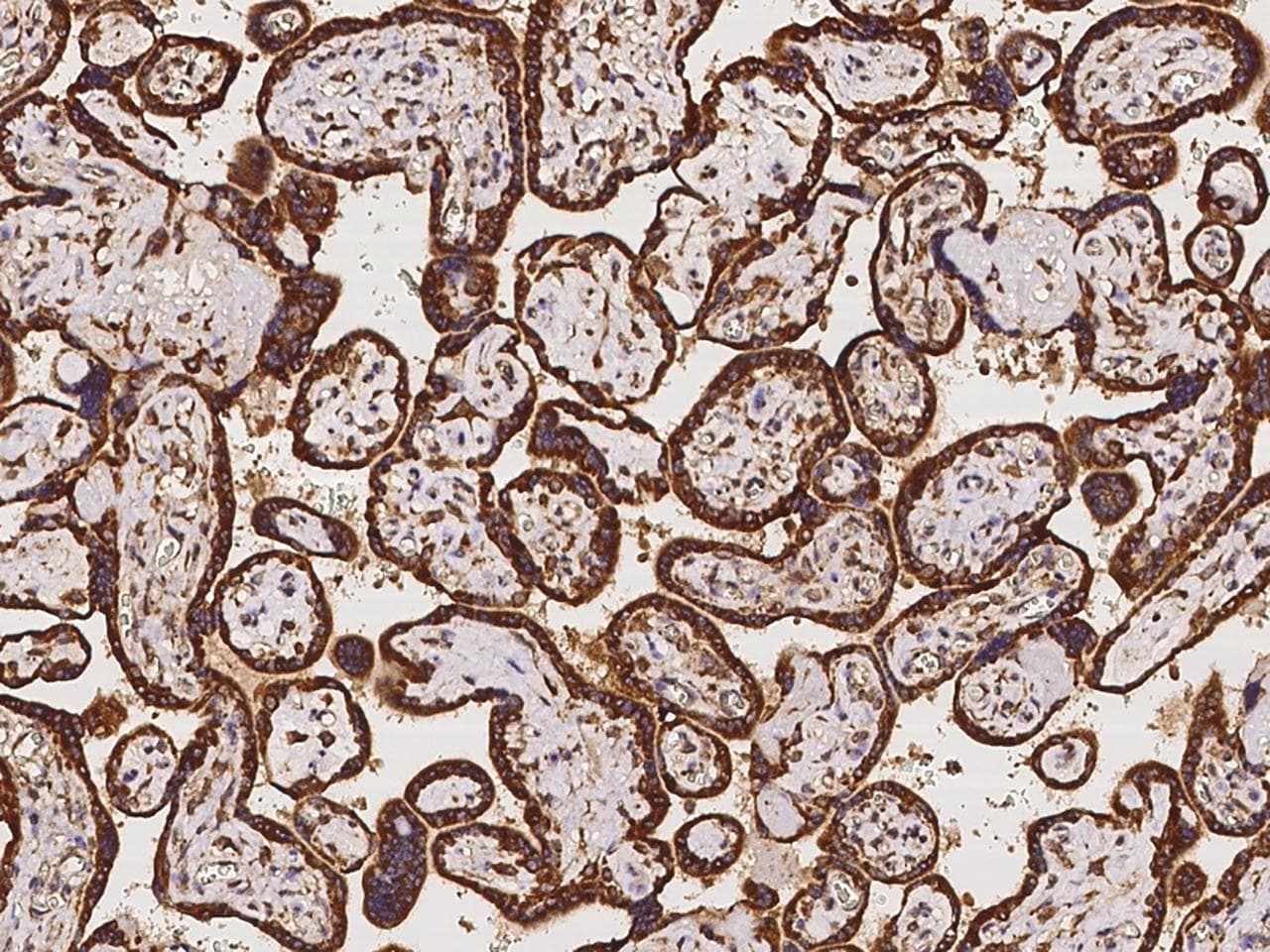 ZNF195 Antibody