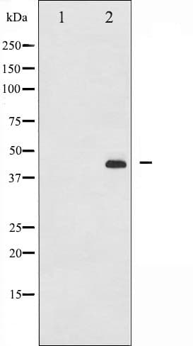 MAP2K1 / MKK1 / MEK1 Antibody (phospho-Ser217)