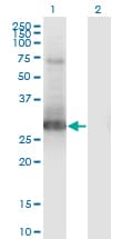 PRX-1 / PRRX1 Antibody (clone 1E2)