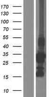 CCS Protein (Over-Expression Lysate Myc-DDK (Flag))