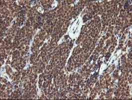 TRMT2A Antibody (clone OTI1C3)