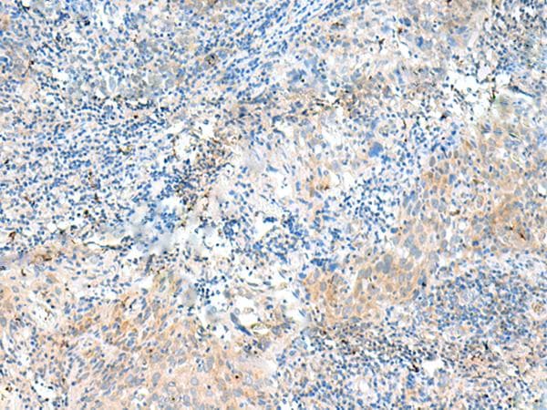 Polyclonal Rabbit anti-Human NID2 / Nidogen-2 Antibody (IHC)
